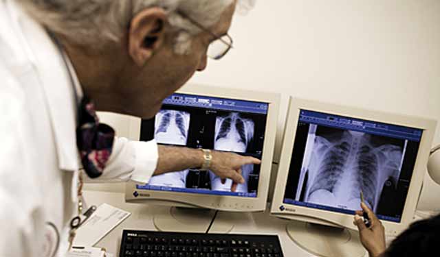 Lutte contre la tuberculose