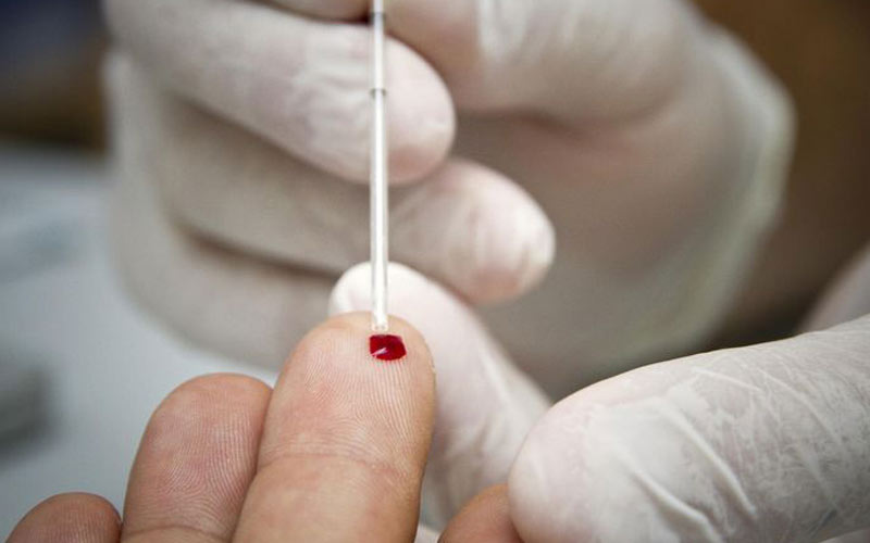 L’ALCS lance sa campagne de dépistage contre le sida