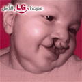 LG : Pour le sourire d’un enfant