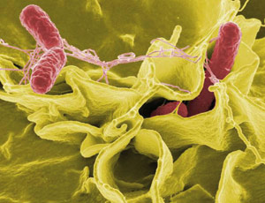 Salmonella Kentucky : Le Maroc n’est pas à l’abri
