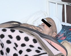Alzheimer : Calvaire et chagrin