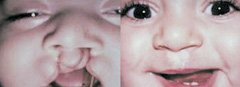 Pour le sourire d’un enfant…