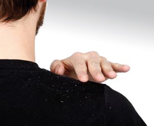 Le sel évite-t-il les pellicules des cheveux ?