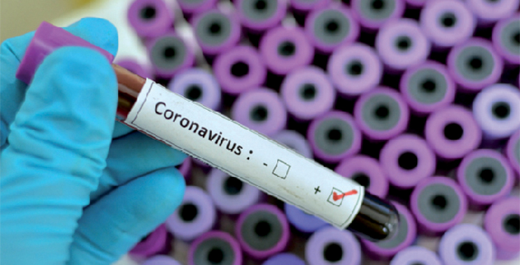 Coronavirus : 9 nouveaux cas confirmés au Maroc