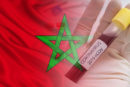 Covid-19 / Maroc : La situation épidémiologique au 16 mai 2022 à 15H00